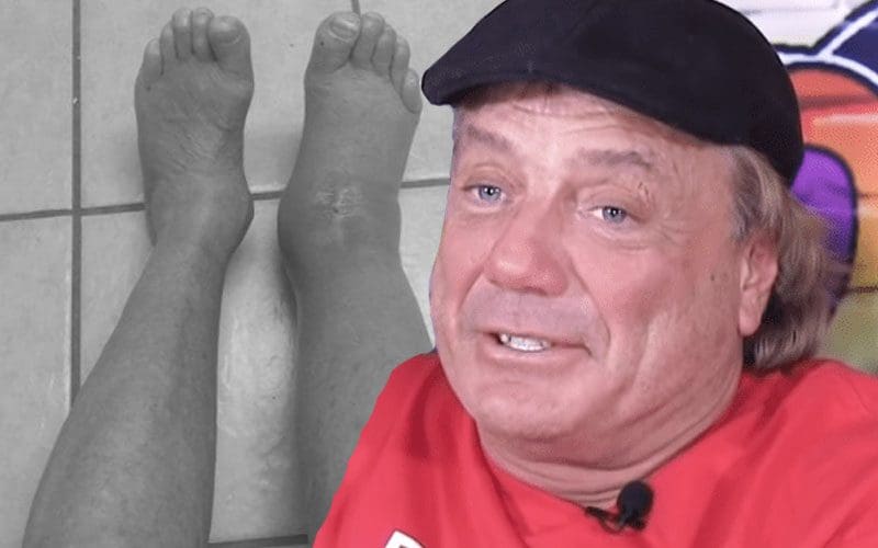 Marty Jannetty Foot Injury: The Real Story Unveiled