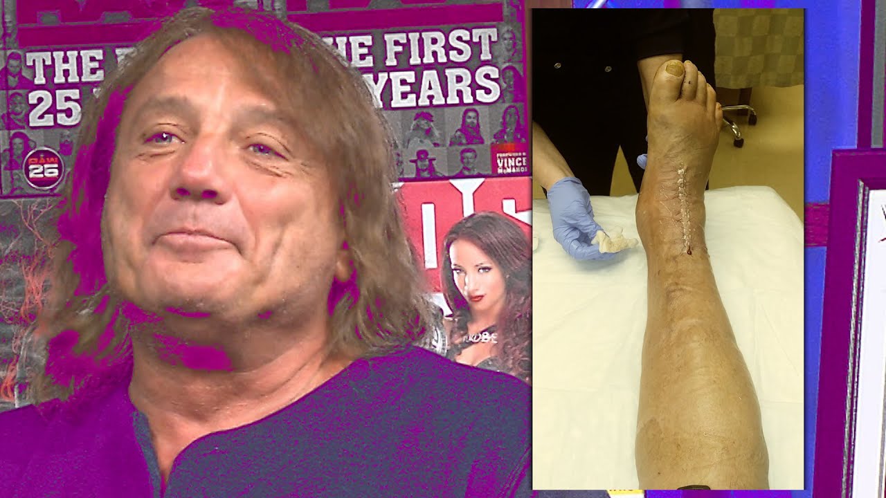 Marty Jannetty Foot Injury: The Real Story Unveiled