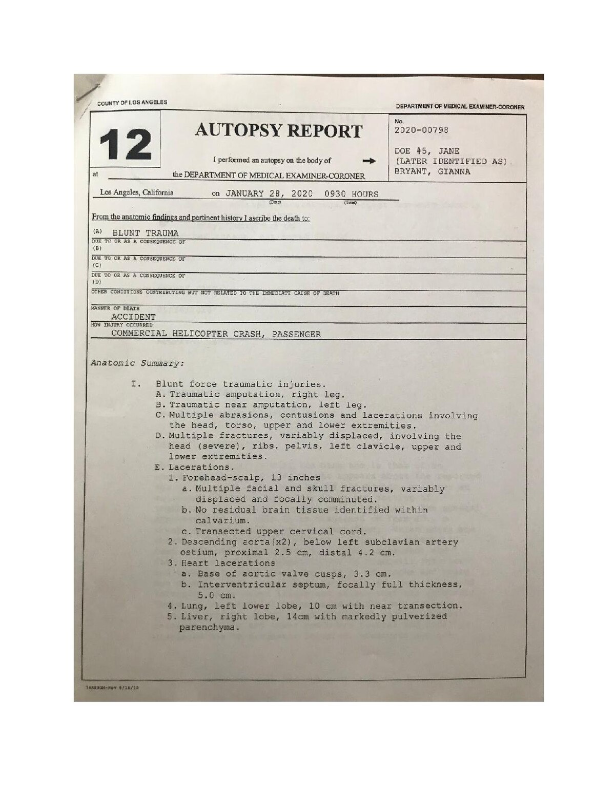 Gigi Bryant Autopsy Report Released: What We Know Now (Full Summary and Easy to Understand)