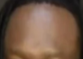 KSI forehead jokes: Whats the deal with his big forehead