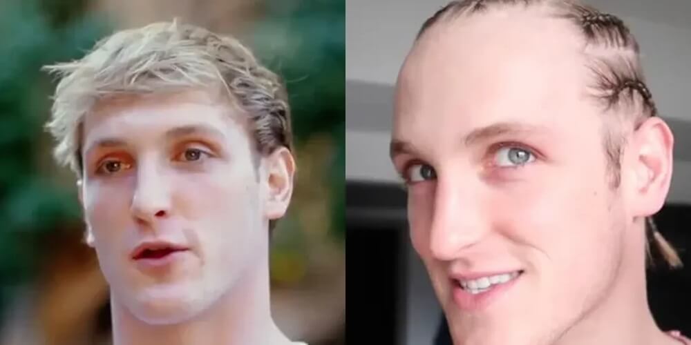 Logan Pauls Haircut Evolution: From Then to Now